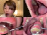歯姫 49人目 [FBOM-00112]
