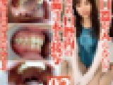 優しいエロエロOLカノン開口器が入らない!?小さめ口腔内銀歯３本接写
