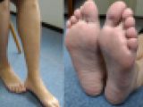 2x才 高身長女性さん 足裏写真集